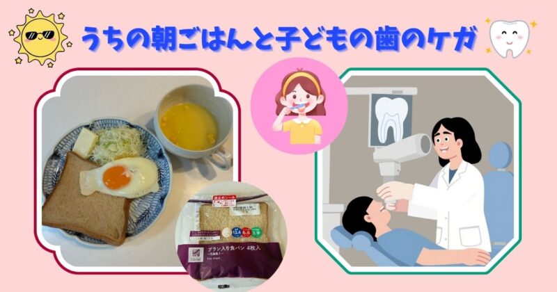 朝の食卓に並ぶ食パンの朝ごはんと、子どもの歯の怪我に向き合った出来事を表したアイキャッチ画像